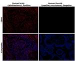 CD56 Antibody