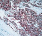 CD56 Antibody in Immunohistochemistry (IHC)