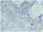 CD56 Antibody in Immunohistochemistry (IHC)