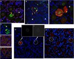 CD56 Antibody in Immunohistochemistry (IHC)