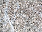 MUM1/IRF4 Antibody in Immunohistochemistry (Paraffin) (IHC (P))