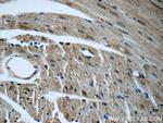 GRP78/BIP Antibody in Immunohistochemistry (Paraffin) (IHC (P))