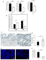 IL-17A Antibody in Immunohistochemistry (Paraffin) (IHC (P))