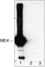 STAT5 alpha Antibody in Western Blot (WB)