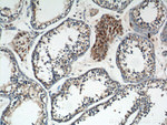 TNF beta Antibody in Immunohistochemistry (Paraffin) (IHC (P))