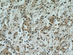 STAT5A Antibody in Immunohistochemistry (Paraffin) (IHC (P))