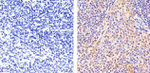 STAT5 beta Antibody in Immunohistochemistry (Paraffin) (IHC (P))