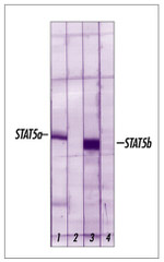 STAT5 beta Antibody in Western Blot (WB)