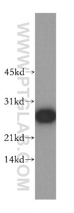 PRDX6 Antibody in Western Blot (WB)