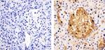 STAT3 Antibody in Immunohistochemistry (Paraffin) (IHC (P))