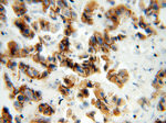 P-cadherin Antibody in Immunohistochemistry (Paraffin) (IHC (P))