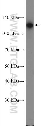 P-cadherin Antibody in Western Blot (WB)