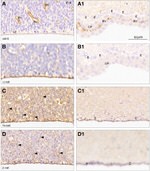 beta Catenin Antibody in Immunohistochemistry (IHC)