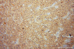 OLIG2 Antibody in Immunohistochemistry (Paraffin) (IHC (P))