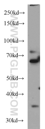 OLIG2 Antibody in Western Blot (WB)