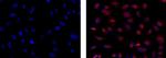 Mouse IgG1 kappa Isotype Control in Immunocytochemistry (ICC/IF)