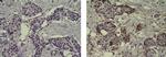 Mouse IgG1 kappa Isotype Control in Immunohistochemistry (Paraffin) (IHC (P))