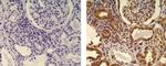 Mouse IgG1 kappa Isotype Control in Immunohistochemistry (Paraffin) (IHC (P))