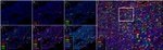 CD4 Antibody in Immunohistochemistry (Paraffin) (IHC (P))