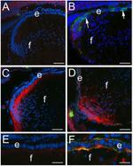 CD44 Antibody in Immunohistochemistry (IHC)