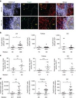 FOXP3 Antibody in Immunohistochemistry (IHC)