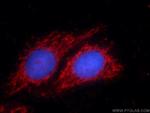 p70(S6K) Antibody in Immunocytochemistry (ICC/IF)