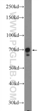 p70(S6K) Antibody in Western Blot (WB)