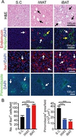 Endomucin Antibody in Immunohistochemistry (IHC)