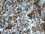 SDHA Antibody in Immunohistochemistry (Paraffin) (IHC (P))