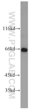 SDHA Antibody in Western Blot (WB)