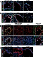 FOXJ1 Antibody in Immunohistochemistry (IHC)