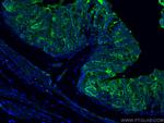 ALDH1A1 Antibody in Immunohistochemistry (PFA fixed) (IHC (PFA))