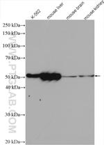 ALDH1A1 Antibody in Western Blot (WB)