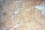 Lin28A Antibody in Immunohistochemistry (Paraffin) (IHC (P))