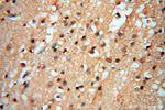 Lin28A Antibody in Immunohistochemistry (Paraffin) (IHC (P))