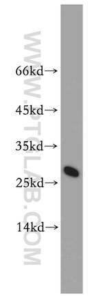 Lin28A Antibody in Western Blot (WB)