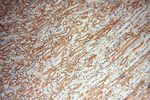 GM-CSF Antibody in Immunohistochemistry (Paraffin) (IHC (P))