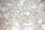 GM-CSF Antibody in Immunohistochemistry (Paraffin) (IHC (P))