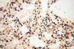 GM-CSF Antibody in Immunohistochemistry (Paraffin) (IHC (P))