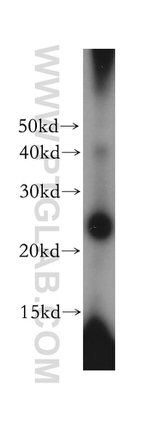 GM-CSF Antibody in Western Blot (WB)