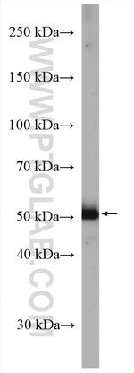 Cytokeratin 10 Antibody in Western Blot (WB)