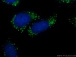 CFTR Antibody in Immunocytochemistry (ICC/IF)