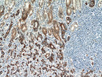 Claudin 18 Antibody in Immunohistochemistry (Paraffin) (IHC (P))