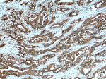 Claudin 18 Antibody in Immunohistochemistry (Paraffin) (IHC (P))