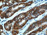 Claudin 18 Antibody in Immunohistochemistry (Paraffin) (IHC (P))