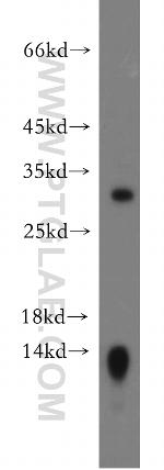 Claudin 18 Antibody in Western Blot (WB)