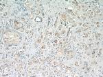 ARF3 Antibody in Immunohistochemistry (Paraffin) (IHC (P))