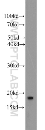 ARF3 Antibody in Western Blot (WB)