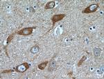 SYNJ1 Antibody in Immunohistochemistry (Paraffin) (IHC (P))