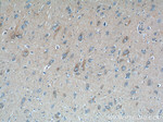 ATG9A Antibody in Immunohistochemistry (Paraffin) (IHC (P))